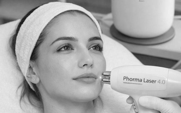 Laserová výplň vrások 1 bw Laserová výplň vrások 1 bw