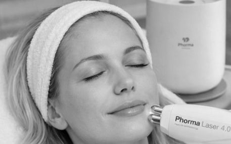 Laserová výplň vrások 2 bw Laserová výplň vrások 2 bw