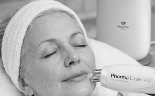 Laserová výplň vrások 3 bw Laserová výplň vrások 3 bw